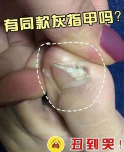 ​爆红口咬秘籍曝光，超实用视频教程流出！