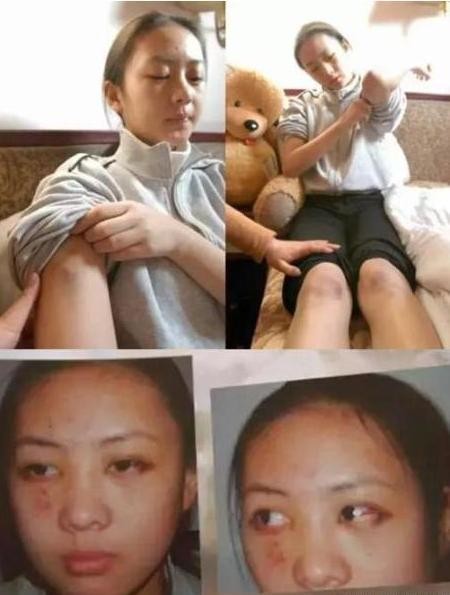 张默事件，张默打童谣视频(张默打童谣怎么回事)