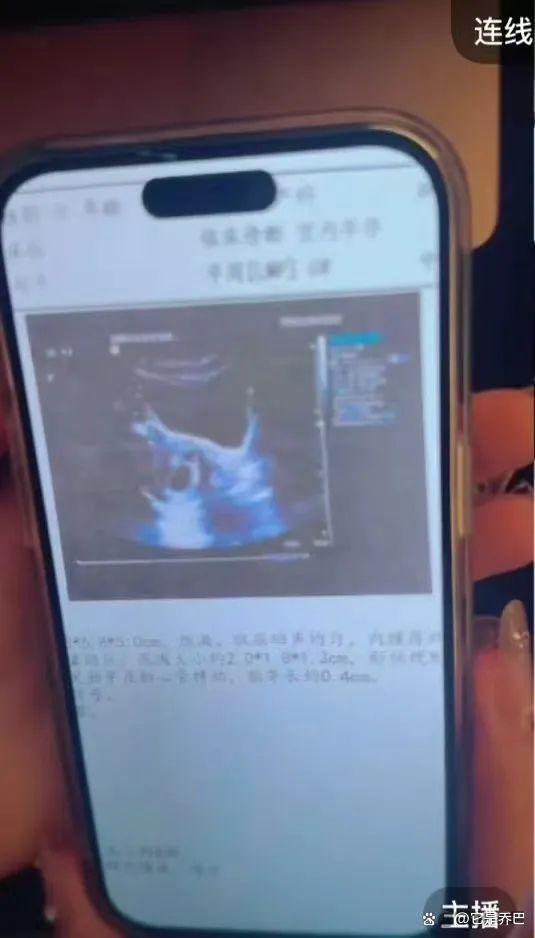 胡文煊道歉承认与前女友有过孩子 胡文煊出轨时间线