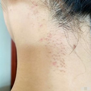 ​杨紫回应现身整形美容医院 抽空去护肤和祛个碎发而已想多了