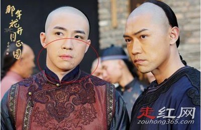 俞灏明烧伤事件的原因 究竟是怎样被烧伤的