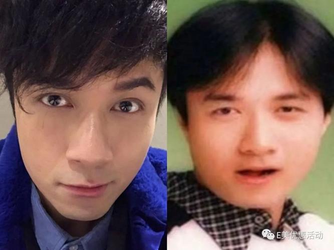 陈伟霆整容,蒜头鼻照片,本文共(3454字) 陈伟霆整容,蒜头鼻照片,本文共(3454字)