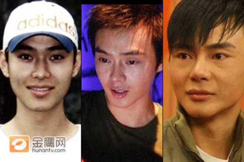 侣皓吉吉整容前后,整容失败图片,本文共(3444字) 侣皓吉吉整容前后,整容失败图片,本文共(3444字)