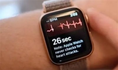 ​AppleWatch未来或将无创测血糖 无创测血糖手表靠谱吗?