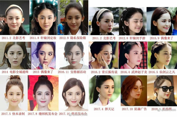 古力娜扎整容过吗 古力娜扎现在怎么样了